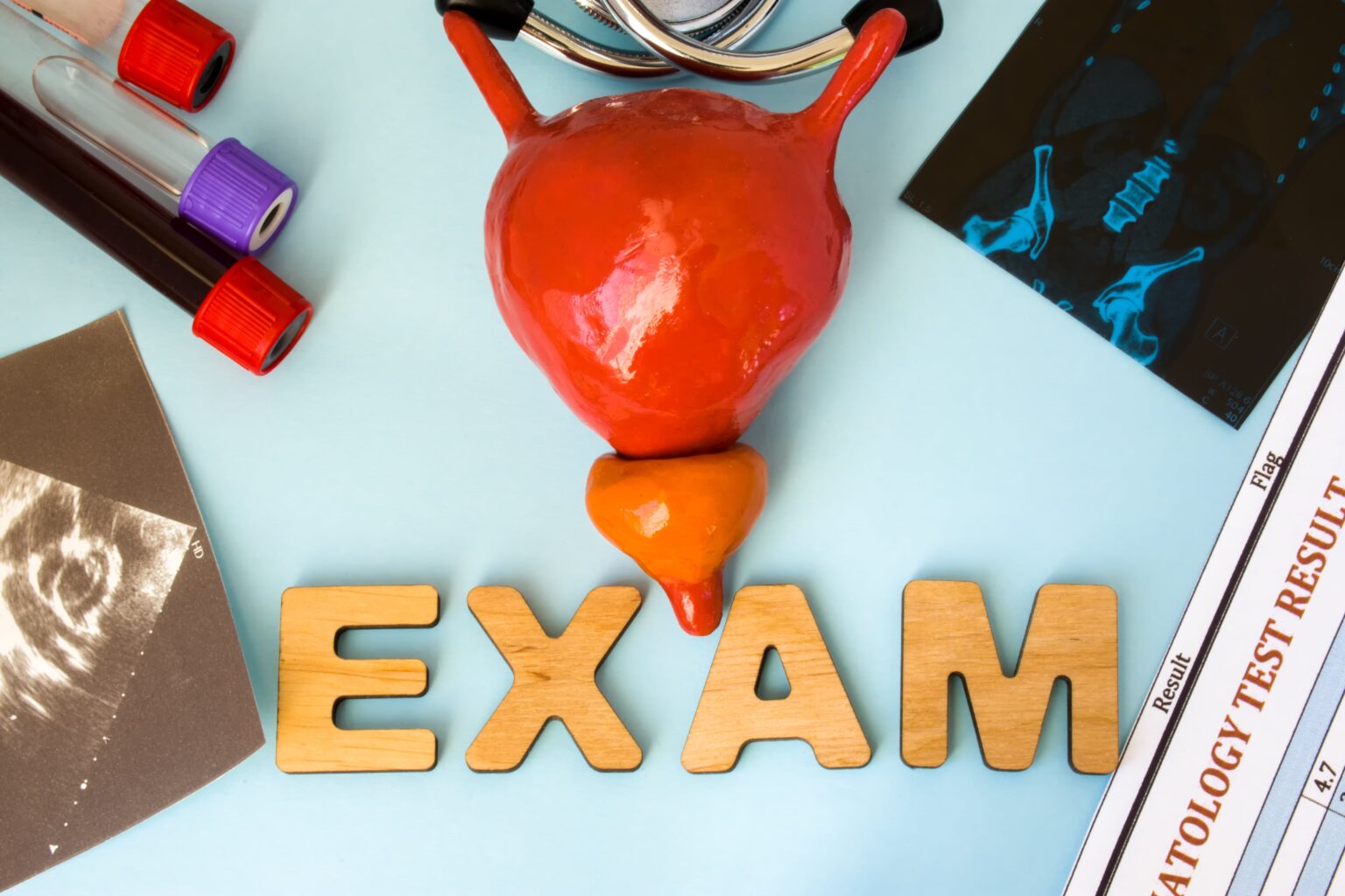 What to Expect at a Prostate Cancer Screening | NYC | SoHo Men's Health