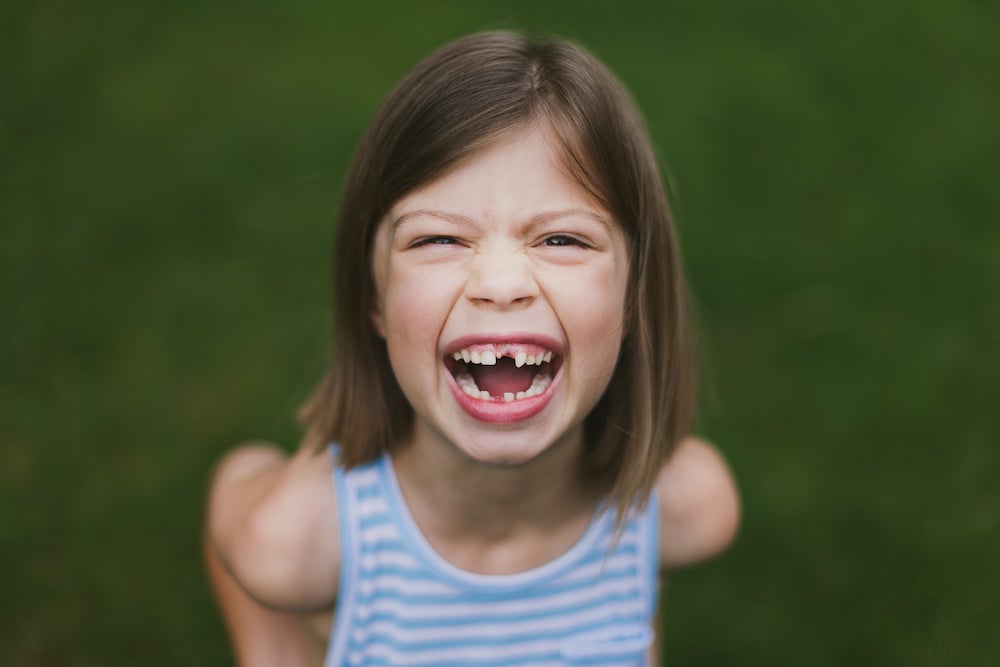 Joyful Smile Of Girl With Missing Teeth