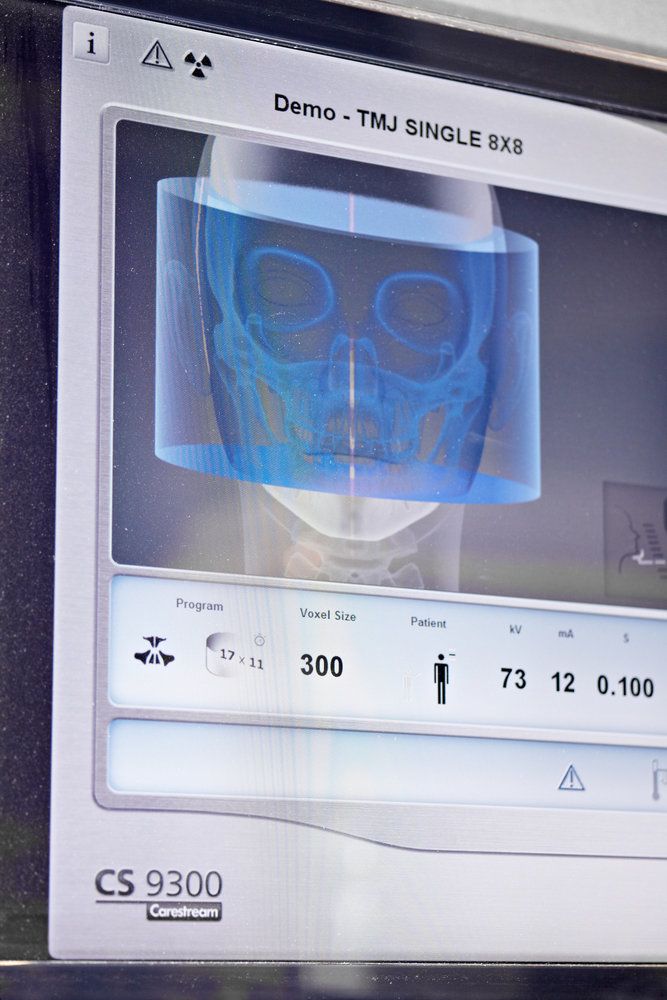 3D image of human skull for dentist work
