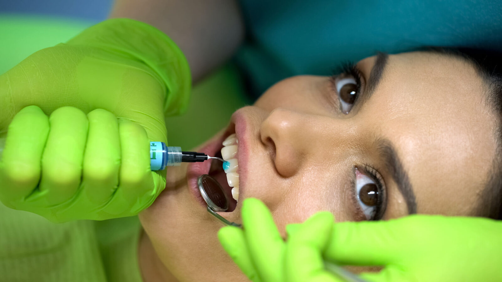 dentist in Coral Springs fixes broken tooth