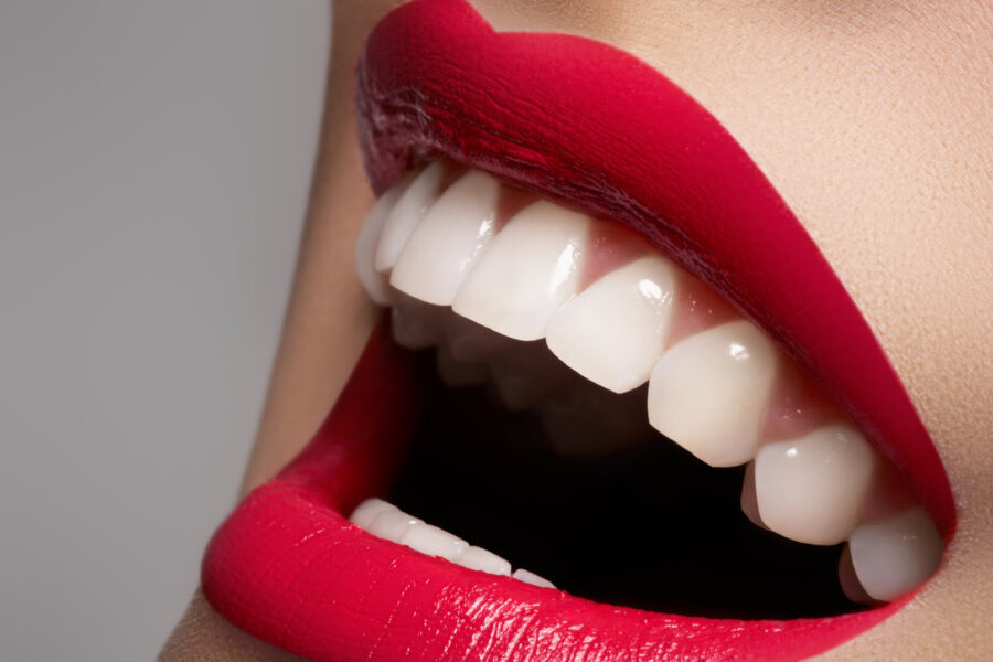 woman with red lips showing her white teeth after teeth whitening in coral springs