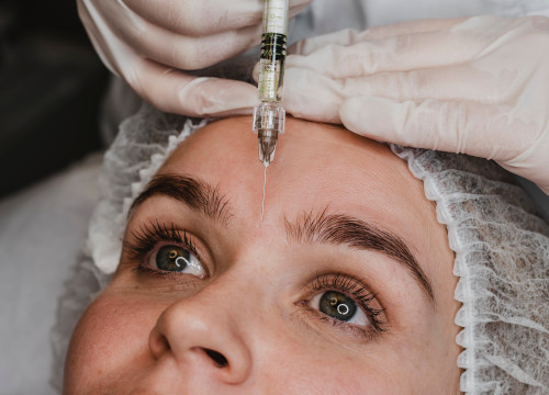 facial fillers injection to between brows