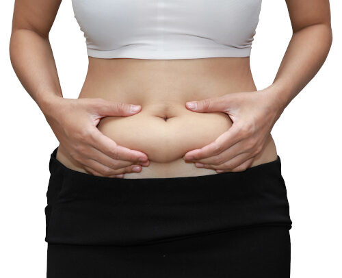 Liposuction procedure illustration for cosmetic body contouring in King of Prussia, PA