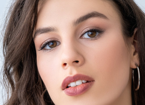 Lip injections in King of Prussia, PA improving lip definition and facial balance