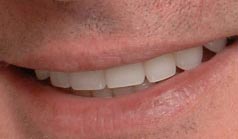 46 year old male presents with unsightly after dental treatment