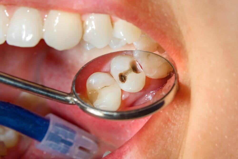 dental treatment in a dental clinic