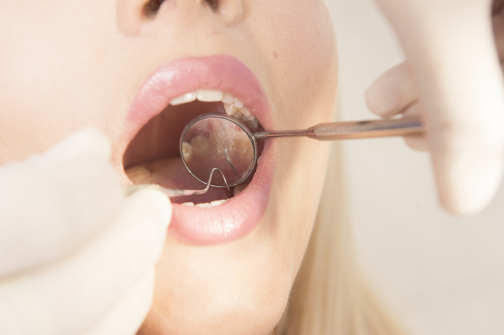 A person getting their Dental Exam and  yearly cleaning 