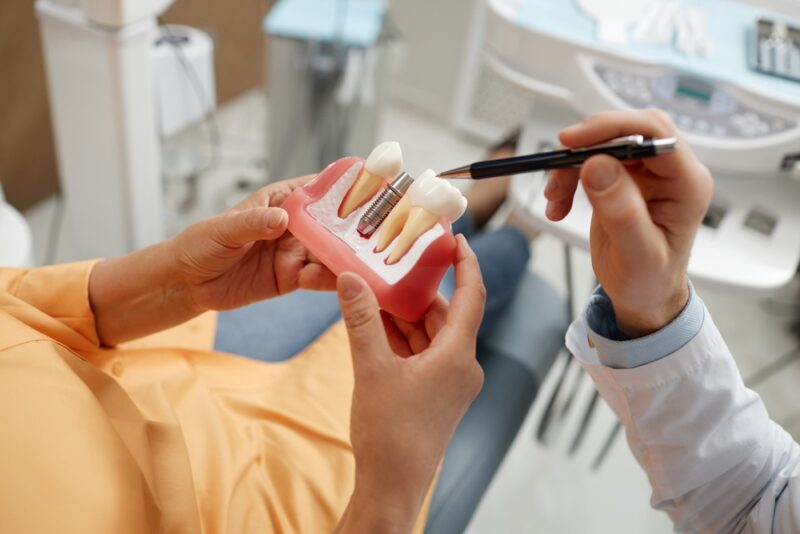 The Advantages Of Dental Implants For Tooth Replacement