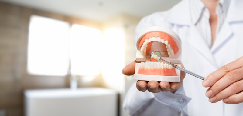 Caring For Dental Bridges And Dentures