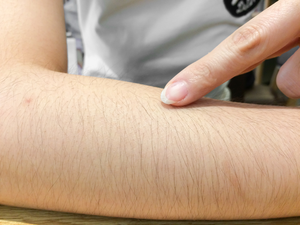 Person with hairy arms looking to get Laser Hair Removal