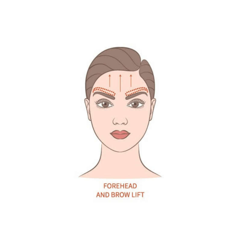 Eyelid Lift vs. Brow Lift: What is the Difference? | Annapolis and ...