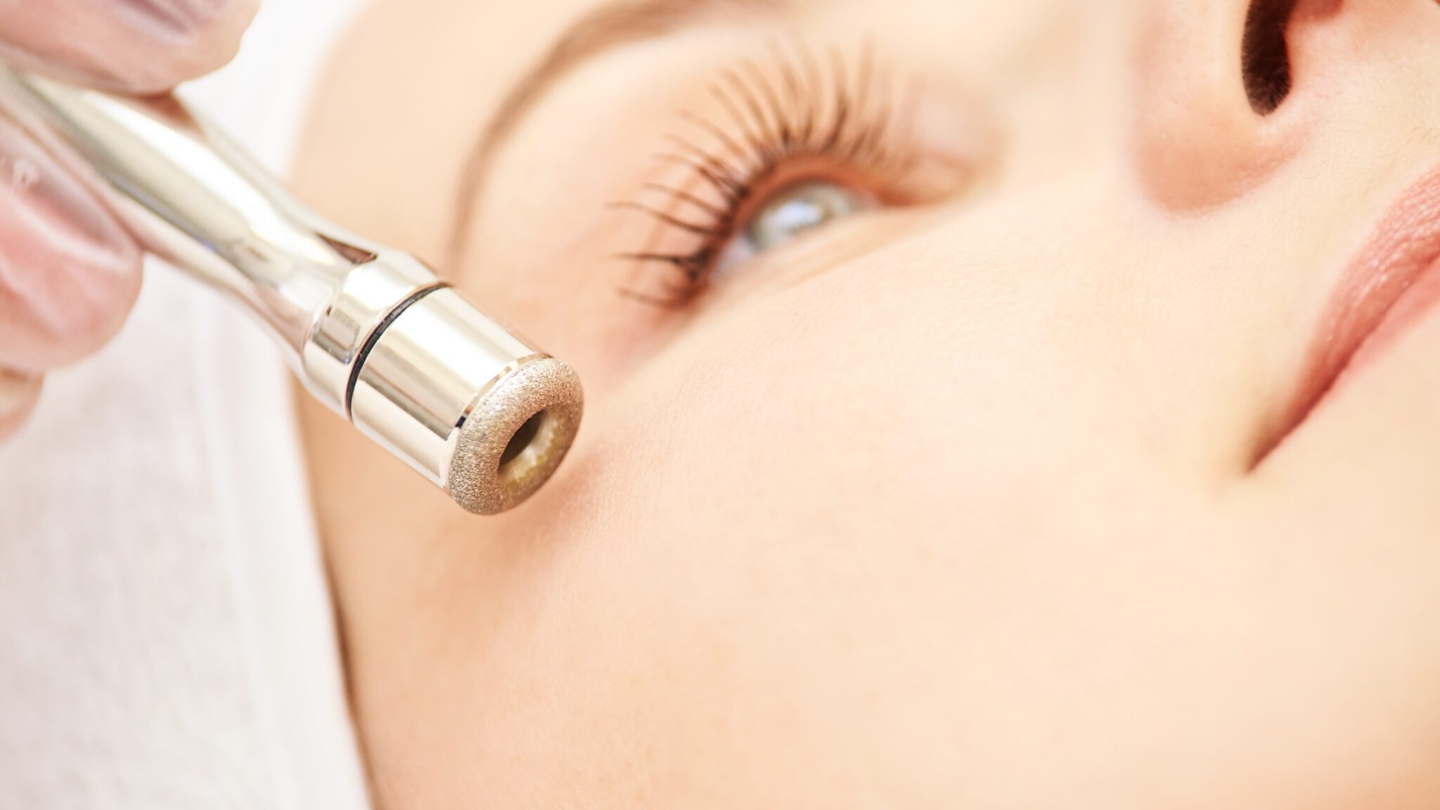 Microdermabrasion vs. Chemical Peel Which is Right for You?