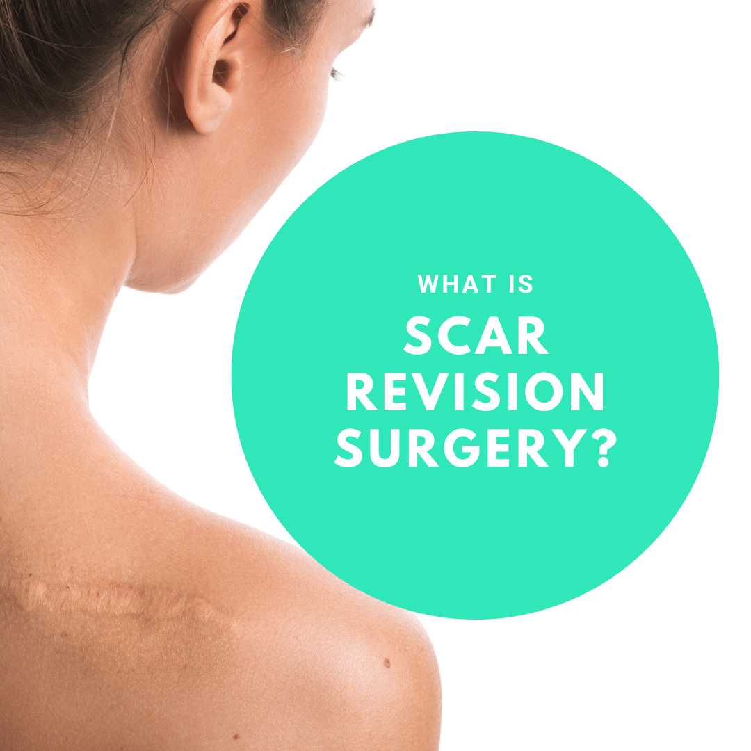 What is scar revision surgery