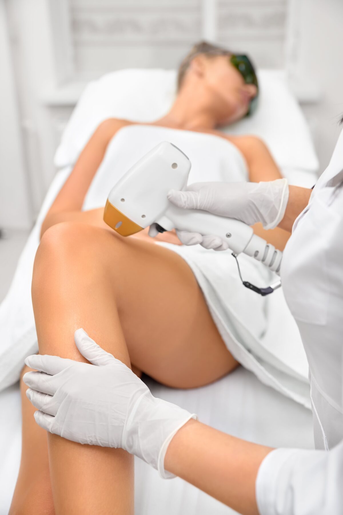 woman having laser hair removal on her legs