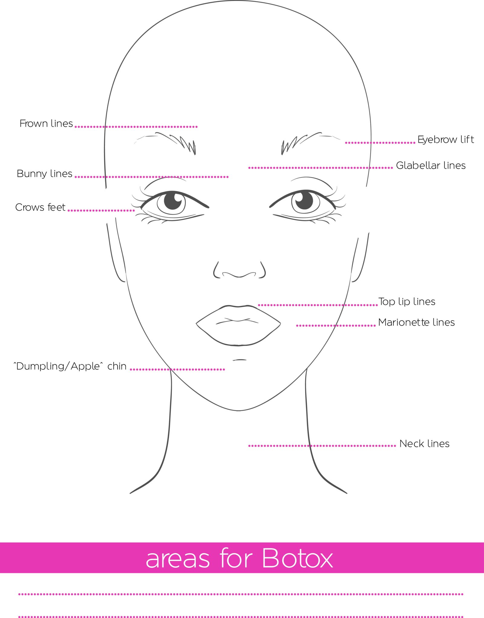 areas for botox injections