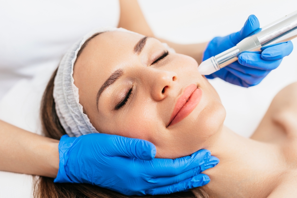A woman smiling while getting SkinPen Microneedling