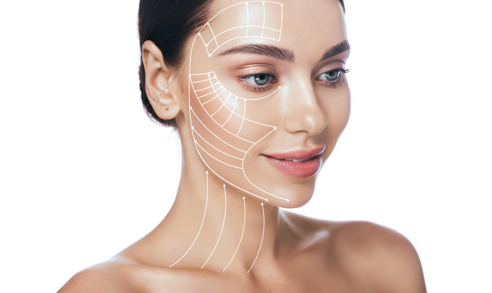 woman's face with surgical lines marked for facelift