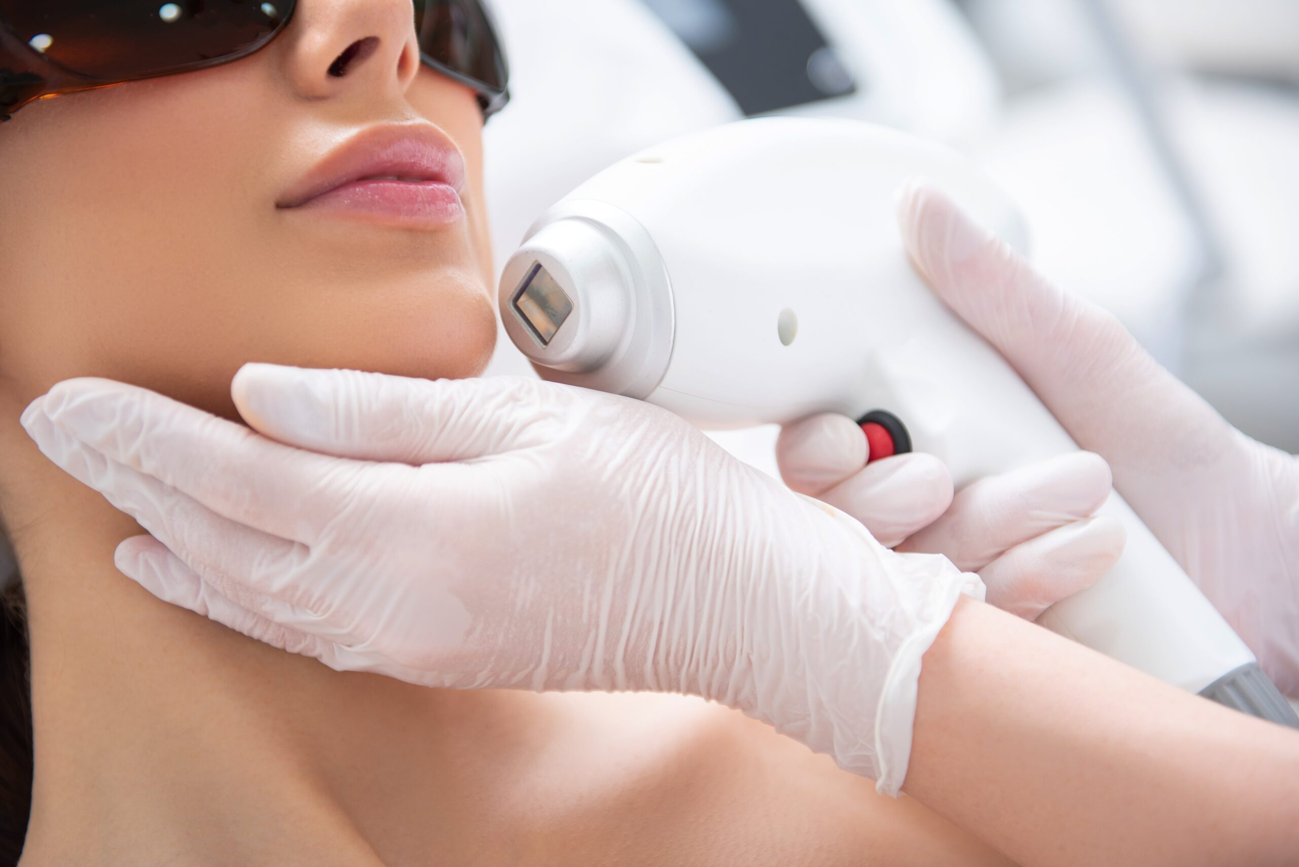 Preparing for Your CO2 Laser Treatment: Essential Tips