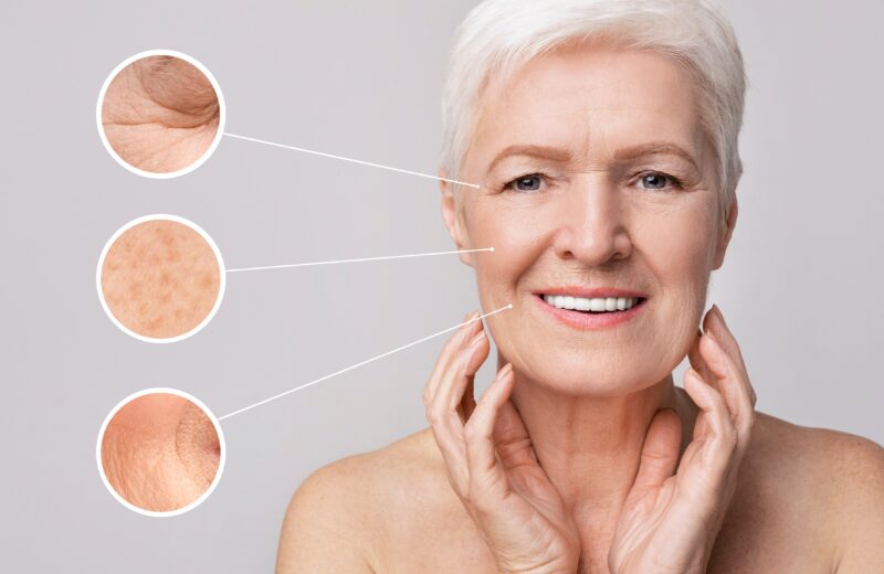Beauty And Skincare. Collage of beautiful senior woman on light background with zoomed zones with skin aging signs