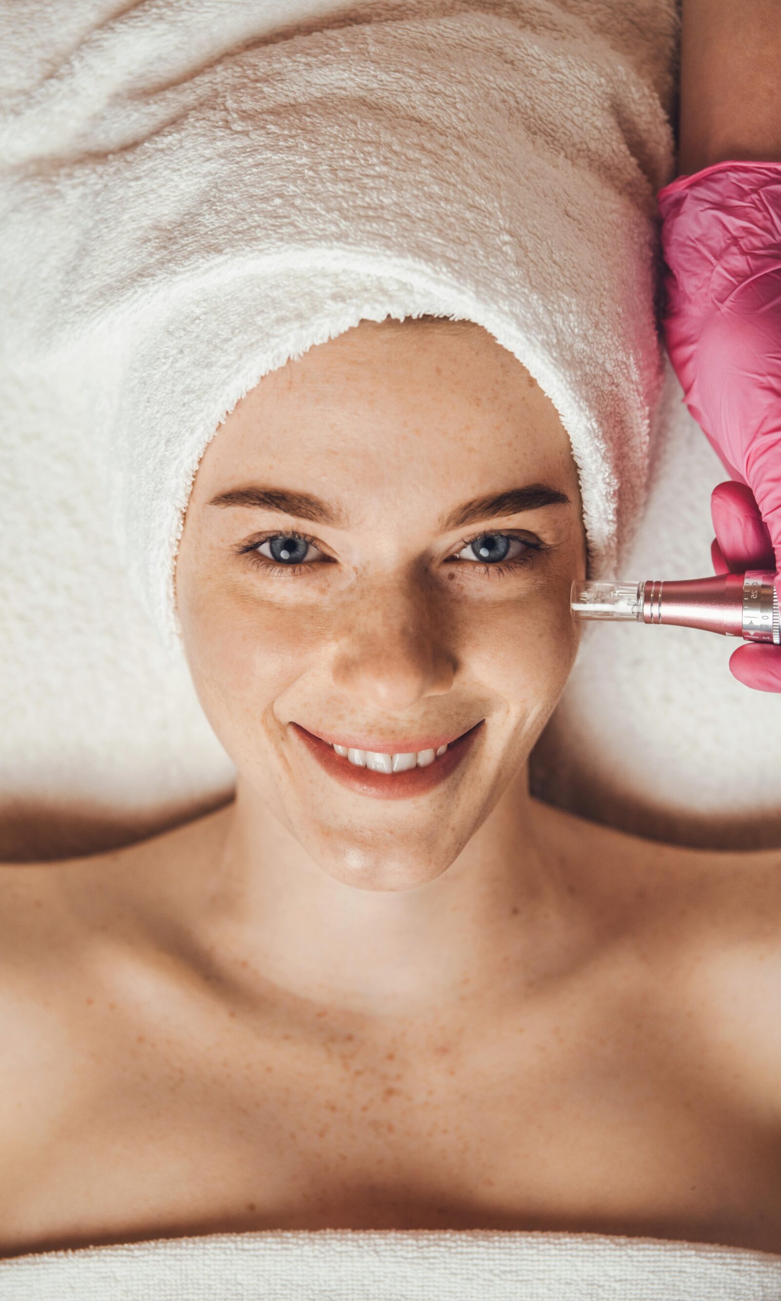 Top view portrait of female face looking at camera getting microdermabrasion procedure in a beauty spa salon. Dermatology, cosmetology. Health care, beauty