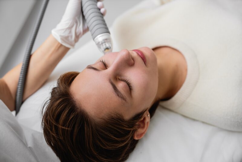 Radiofrequency Microneedling treatment