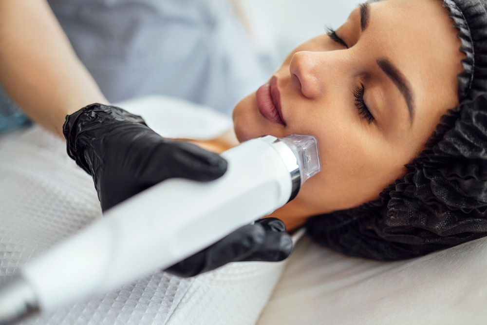 Microneedling: A Natural Way to Rejuvenate Your Skin