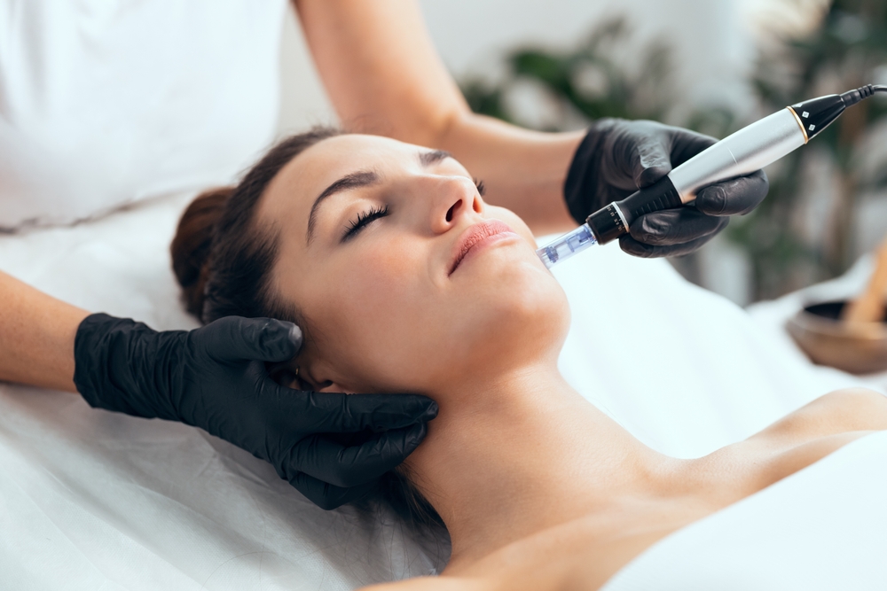 Microneedling for Skin Rejuvenation: How It Can Help Improve Texture and Tone