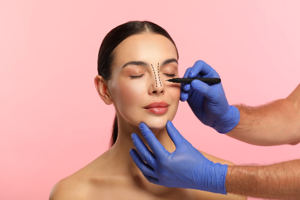 Rhinoplasty