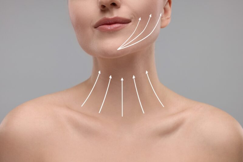 How a Neck Lift Complements a Face Lift for a Complete Rejuvenation