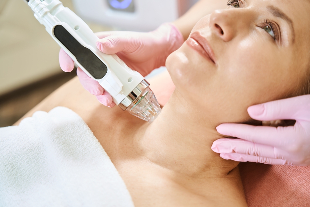 microneedle rf lifting of neck skin of woman