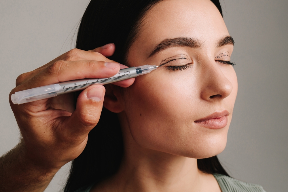 Surgeon is planning process of upper blepharoplasty with marker. Surgeon is drawing marking lines on eyelid of patient to have accurate operation