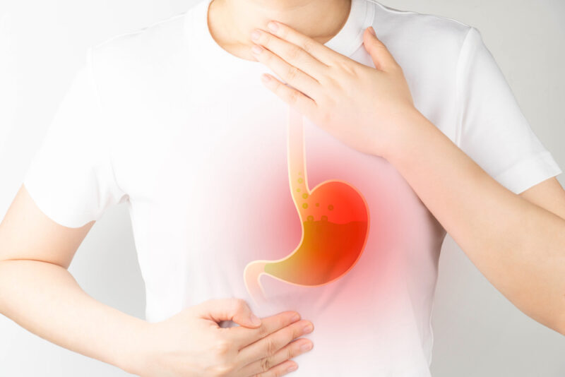 Gastroesophageal reflux disease (GERD) or acid reflux symptoms.