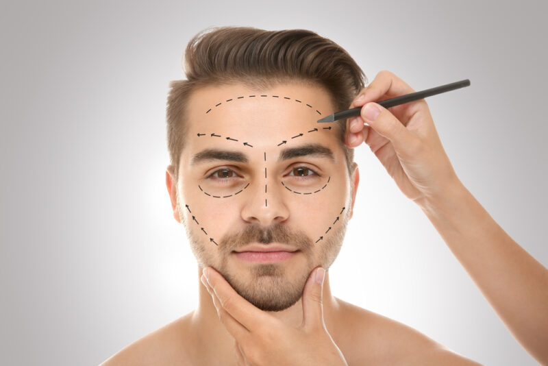 Facial plastic surgery is no longer a trend reserved for women, as more men are turning to these procedures to enhance their appearance, maintain a youthful look, or refine features while staying true to their masculine identity. Male patients have distinct facial structures, skin qualities, and aesthetic goals that require a specialized approach. From subtle refinements to more transformative procedures, today’s facial plastic surgeons use customized techniques designed specifically for men, ensuring results that are natural, balanced, and confidence-boosting. In This Blog: Understanding Male Facial Aesthetics Common Surgical Procedures for Men Customized Approaches and Techniques The Role of Non-Surgical Enhancements Psychological and Lifestyle Considerations Choosing the Right Surgeon Understanding Male Facial Aesthetics Male facial anatomy differs significantly from female features, and these differences shape the surgical approach. Men typically have stronger bone structures, thicker skin, and distinct hair patterns. Their aesthetic goals often focus on creating or maintaining strength, symmetry, and definition rather than softness or refinement. A successful outcome must preserve a natural, masculine appearance that looks appropriate for age and lifestyle. Common Surgical Procedures for Men Rhinoplasty Men often seek rhinoplasty to improve proportion and breathing while keeping a strong, natural profile. Surgeons carefully refine the nose without over-narrowing or reshaping in a way that could appear feminine. Blepharoplasty (Eyelid Surgery) Eyelid surgery helps reduce drooping lids or under-eye bags that make men appear tired or older. The goal is a refreshed, alert appearance that still feels rugged and natural. Neck Lift & Chin Augmentation A well-defined jawline is a hallmark of masculinity. Neck lifts remove sagging skin and excess fat, while chin augmentation enhances strength and balance in facial proportions. Facelift Men may choose a facelift to address deep lines, sagging, and jowls. Surgeons use specialized techniques that lift and tighten while preserving natural contours, avoiding an overdone or “pulled” look. Customized Approaches and Techniques Customization is key when operating on male patients. Surgeons adapt incision placement to respect beard growth and hairline patterns. They also avoid overcorrection, which can soften features excessively. Instead, the goal is to rejuvenate and refine while maintaining age-appropriate masculinity. Every treatment plan is individualized, ensuring that results complement the patient’s natural bone structure and unique goals. The Role of Non-Surgical Enhancements Not every man is ready for surgery or needs it. Non-surgical treatments play a significant role in enhancing results: Botox (“Brotox”) helps reduce forehead lines and frown creases without affecting natural expression. Dermal fillers restore lost volume or strengthen features such as the jawline or chin. Laser resurfacing and skin treatments improve tone, texture, and sun damage for a healthier look. When combined with surgery, these treatments help achieve comprehensive and long-lasting rejuvenation. Psychological and Lifestyle Considerations Men often pursue facial plastic surgery for reasons that go beyond appearance. Some want to stay competitive in the workplace, while others are motivated by personal confidence or the desire to look as youthful as they feel. Privacy and discretion are also important, as many men prefer subtle changes that don’t draw obvious attention. Recovery planning takes into account busy professional lives and active hobbies, with techniques tailored to minimize downtime. Choosing the Right Surgeon Selecting the right surgeon is essential for achieving results that align with male aesthetics. Look for a board-certified facial plastic surgeon with extensive experience working with male patients. During the consultation, a skilled surgeon will listen to your goals, assess your unique features, and design a personalized plan that balances enhancement with natural results. Conclusion Male facial plastic surgery is about more than changing how you look; it’s about refining and enhancing your natural features in a way that aligns with your goals, confidence, and lifestyle. With customized approaches, men can achieve results that are strong, natural, and masculine. At Anne Arundel ENT & Facial Plastic Surgery, our board-certified surgeons understand the unique needs of male patients and use advanced techniques to deliver results that enhance your natural features while preserving a masculine appearance. Ready to explore your options? Schedule a consultation at our Annapolis or Severna Park office today and discover how a tailored approach to facial plastic surgery can help you look your best while staying true to who you are.