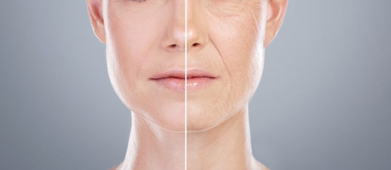Collage, before after and face of woman for skincare, anti aging and beauty with surgery in studio.