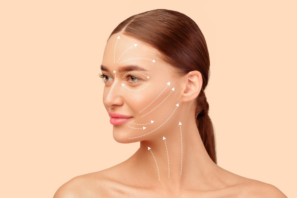 Facelift Routine. Portrait Of Young European Lady With Lifting Arrows Lines On Face Over Beige Studio Background