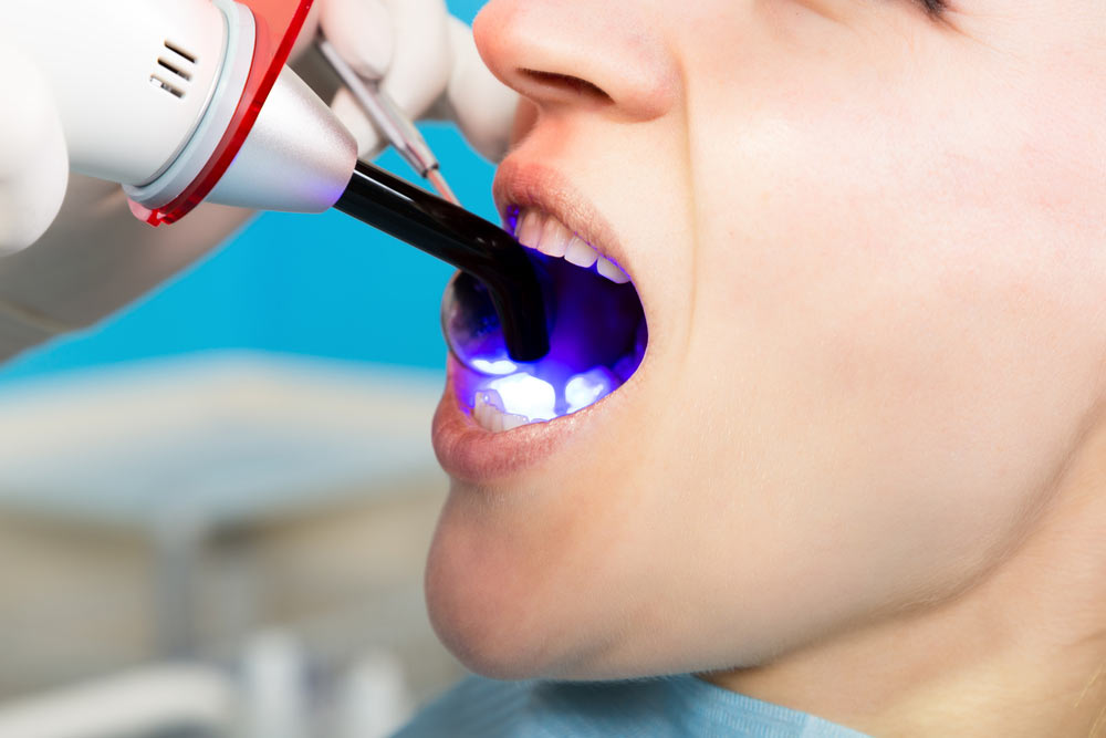 Doctor examines the oral cavity on tooth decay