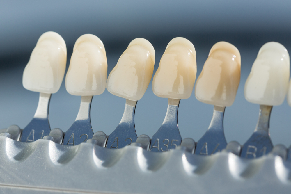 shade guide to check veneer of tooth crown