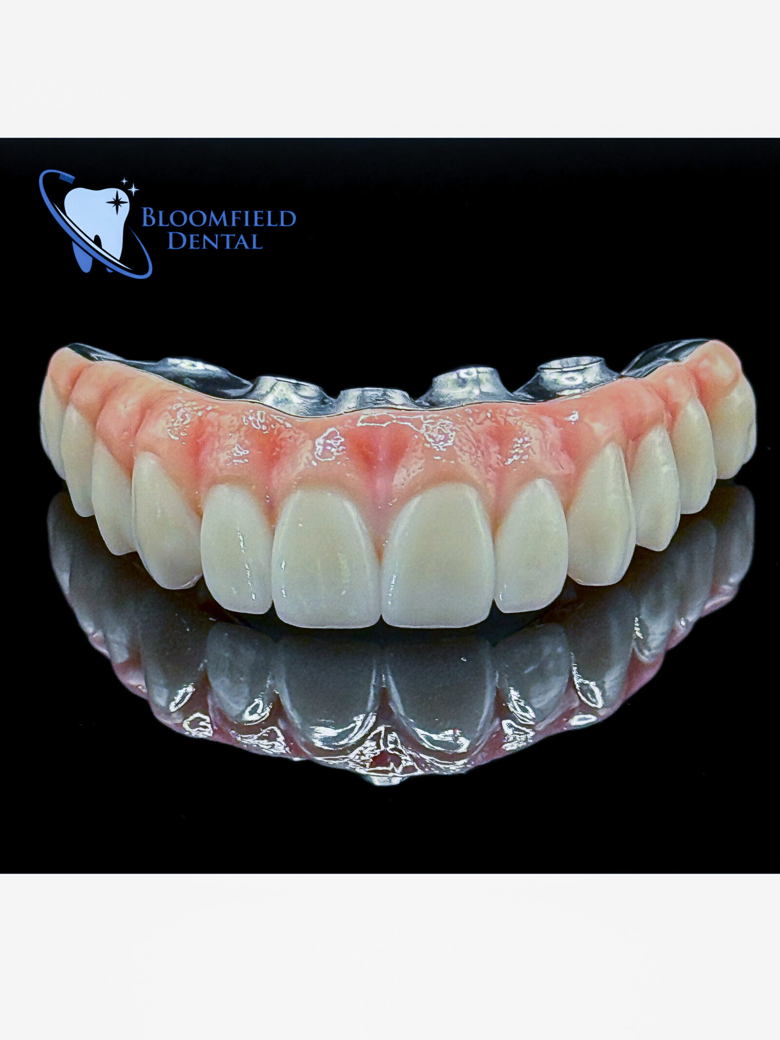 bloomfield dental smile gallery showing the concept of Smile gallery
