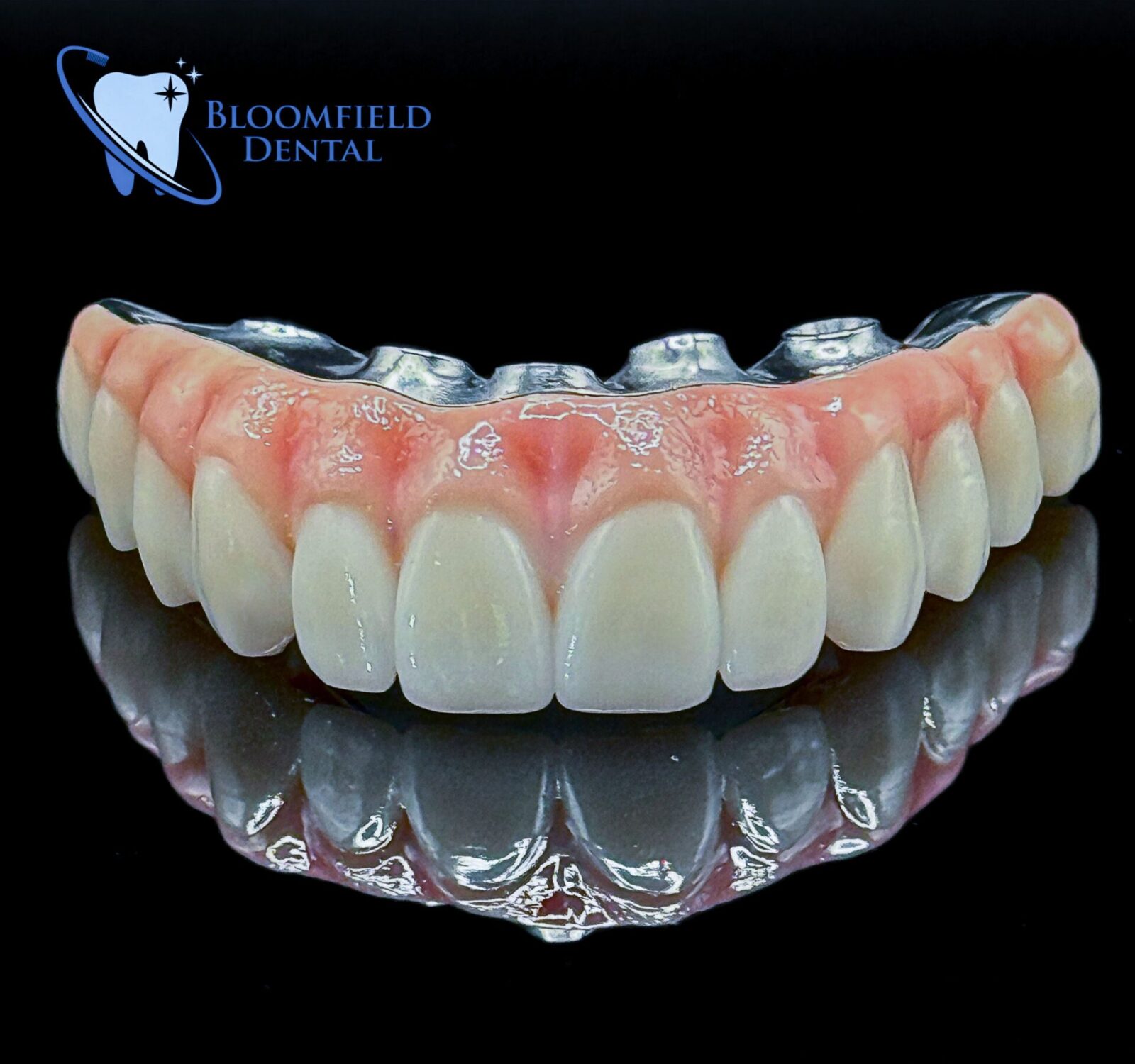 bloomfield dental smile showing the concept of Smile gallery