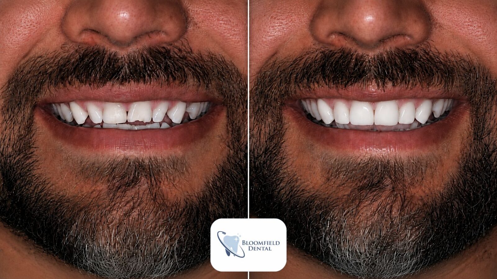AF Case 1 showing the concept of Smile gallery