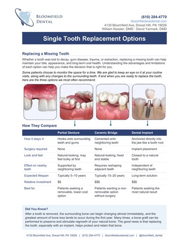 Cover page of Bloomfield Dental's Single Tooth Replacement Options patient guide, comparing partial denture, ceramic bridge, and dental implant options