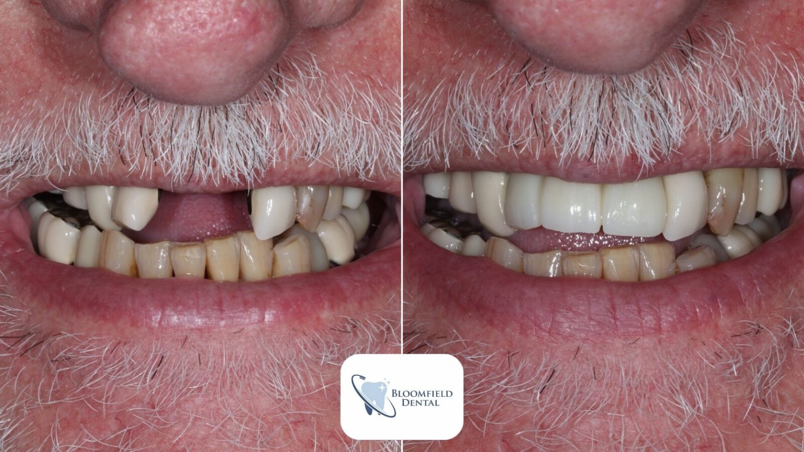 DS Case 1 showing the concept of Smile gallery