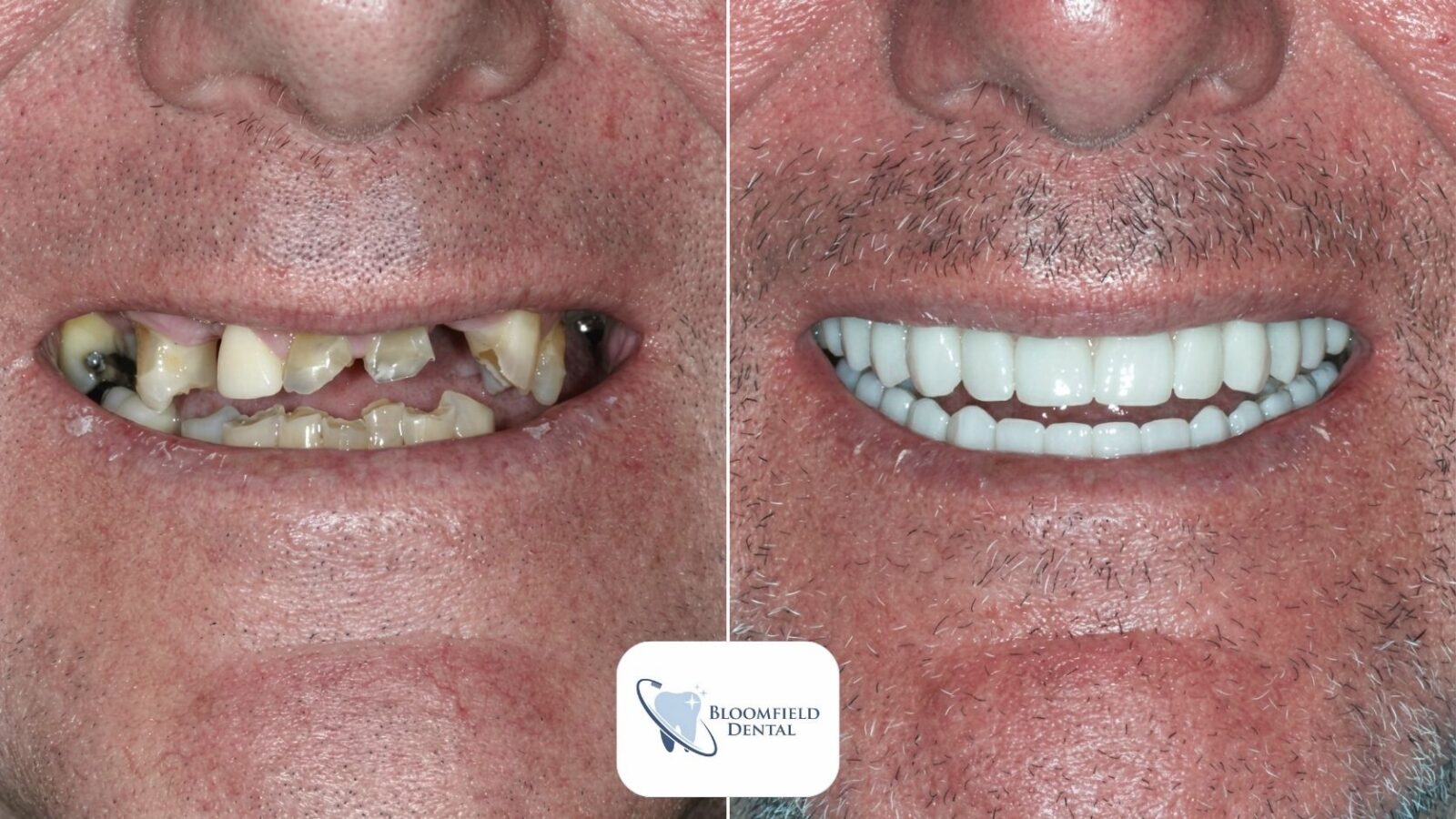 KM Case 1 showing the concept of Smile gallery