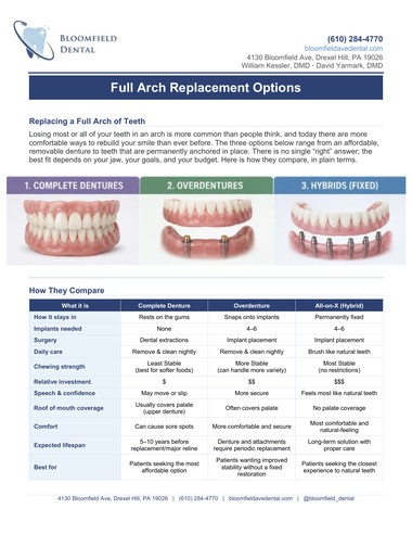 Educational Resources 2 used to demonstrate the concept of Educational Resources Cover page of Bloomfield Dental's Full Arch Replacement Options patient guide, comparing complete dentures, overdentures, and All-on-X hybrid implant options