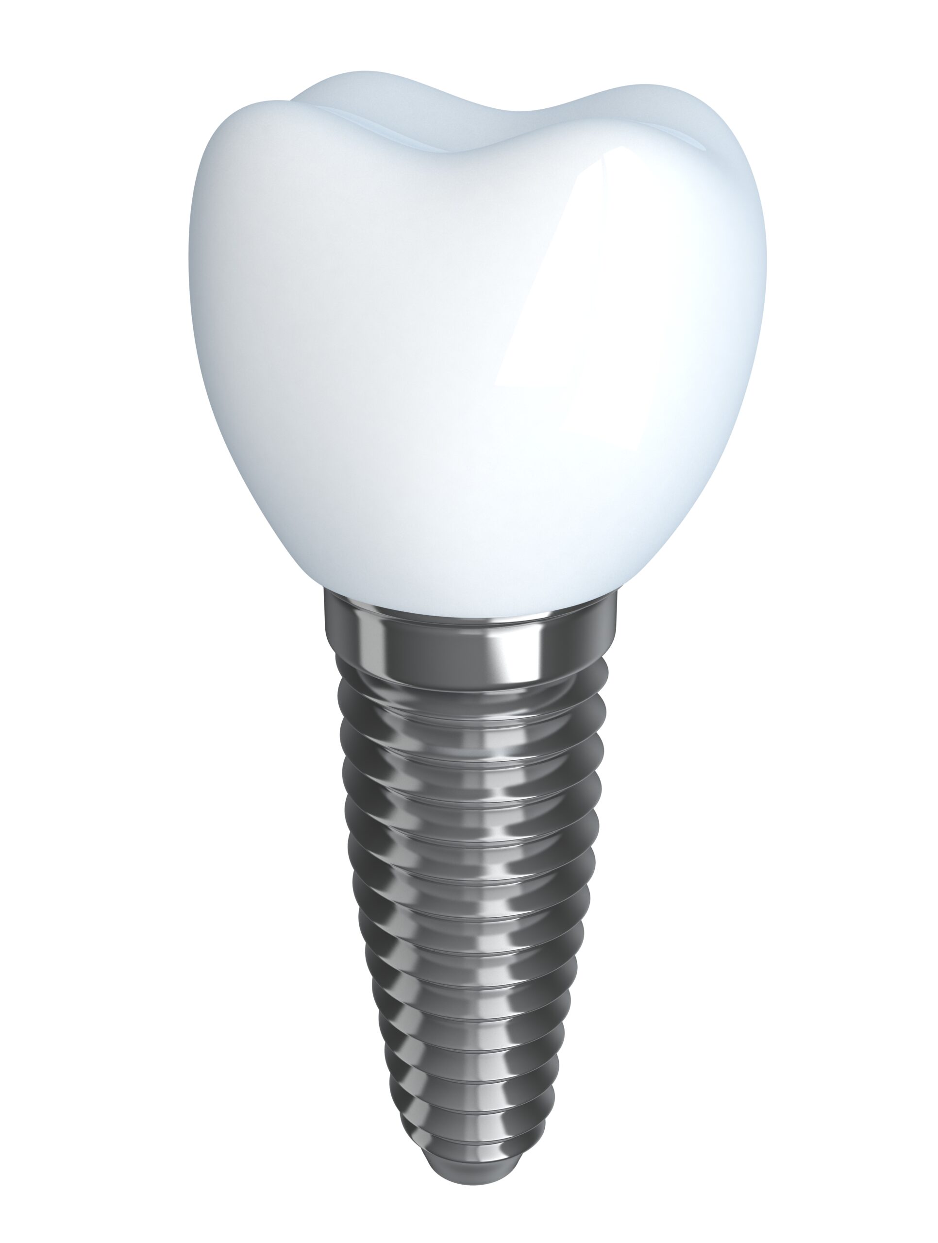 dental implant with crown