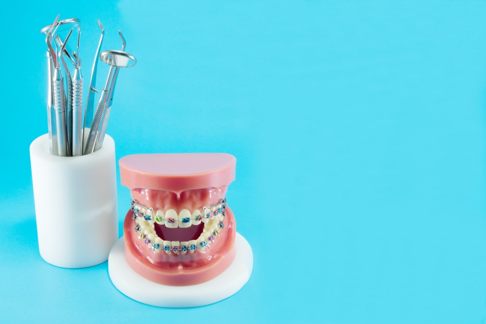 dental mouth model with braces beside a cup of dental tools on a teal background