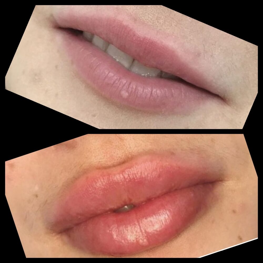 Photo 16 06 2019 22 33 22 showing the concept of Lip Enhancement Gallery