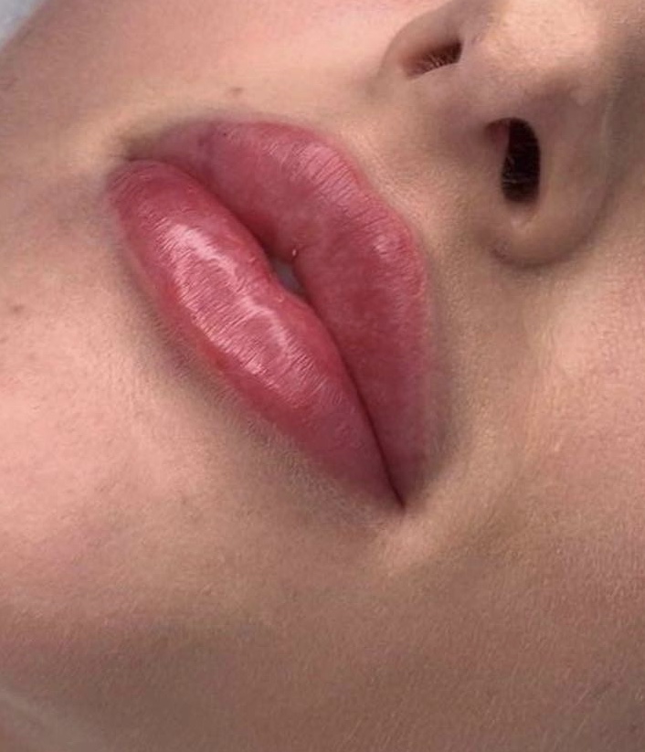 Photo 16 09 2019 00 34 26 showing the concept of Lip Enhancement Gallery