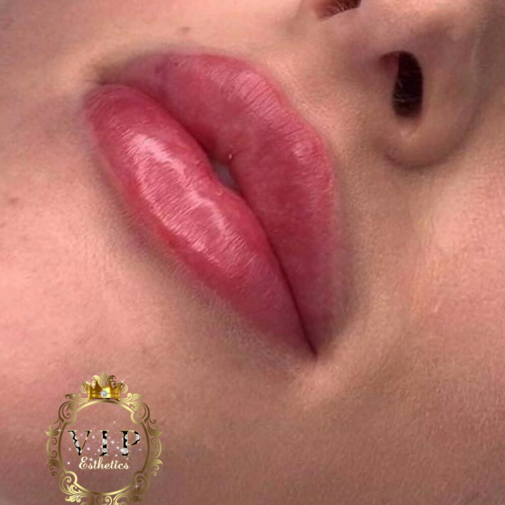 Photo 19 09 2019 18 29 14 showing the concept of Lip Enhancement Gallery