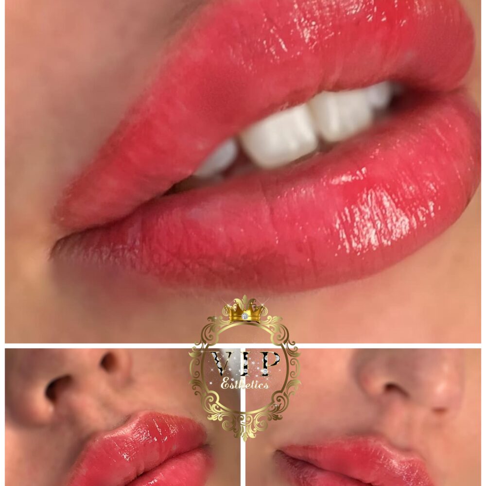 Photo 19 09 2019 18 30 13 1 showing the concept of Lip Enhancement Gallery